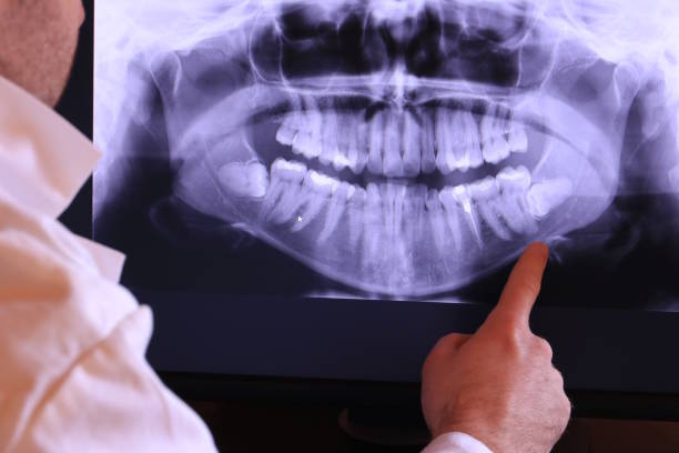 Best Emergency Dental Care for Broken or Chipped Teeth in Nekoosa, WI